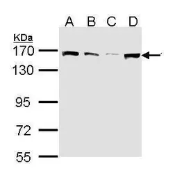 Anti-SMC1A antibody used in Western Blot (WB). GTX113299