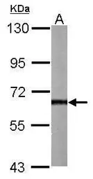 Anti-AKT3 antibody used in Western Blot (WB). GTX113312