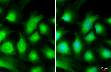 Anti-AKT3 antibody used in Immunocytochemistry/ Immunofluorescence (ICC/IF). GTX113312