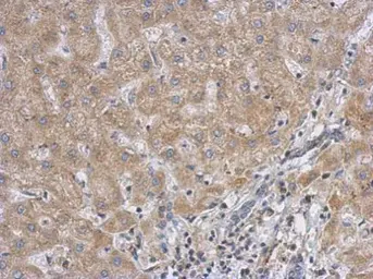 Anti-RACGAP1 antibody [N1N2], N-term used in IHC (Paraffin sections) (IHC-P). GTX113320