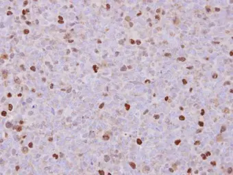 Anti-RACGAP1 antibody [N1N2], N-term used in IHC (Paraffin sections) (IHC-P). GTX113320