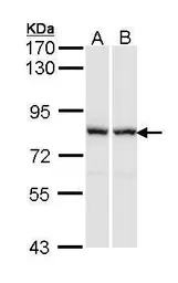 Anti-RACGAP1 antibody [N1N2], N-term used in Western Blot (WB). GTX113320