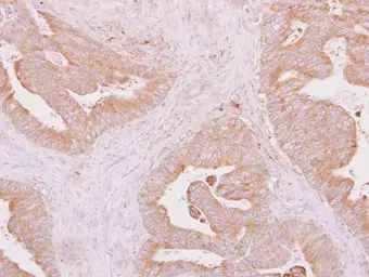 Anti-IRAK4 antibody used in IHC (Paraffin sections) (IHC-P). GTX113323