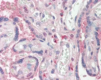 Anti-WWOX antibody used in IHC (Paraffin sections) (IHC-P). GTX113325