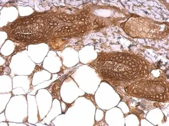 Anti-WWOX antibody used in IHC (Paraffin sections) (IHC-P). GTX113325