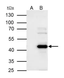 Anti-WWOX antibody used in Immunoprecipitation (IP). GTX113325