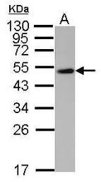 Anti-WWOX antibody used in Western Blot (WB). GTX113325