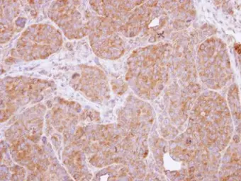 Anti-CARD11 antibody [N1N2], N-term used in IHC (Paraffin sections) (IHC-P). GTX113328