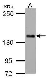 Anti-CARD11 antibody [N1N2], N-term used in Western Blot (WB). GTX113328