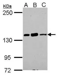 Anti-CARD11 antibody [N1N2], N-term used in Western Blot (WB). GTX113328
