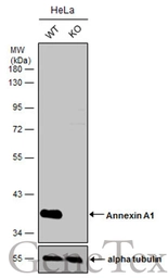 Anti-Annexin A1 antibody used in Western Blot (WB). GTX113329