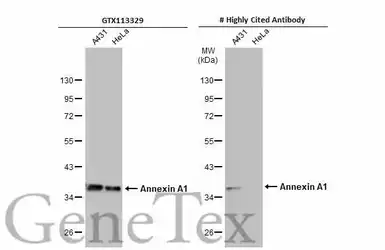 Anti-Annexin A1 antibody used in Western Blot (WB). GTX113329