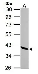 Anti-Annexin A1 antibody used in Western Blot (WB). GTX113329