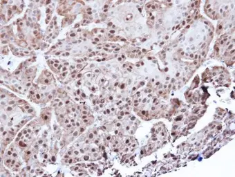 Anti-Annexin A1 antibody used in IHC (Paraffin sections) (IHC-P). GTX113329