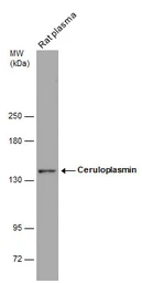 Anti-Ceruloplasmin antibody used in Western Blot (WB). GTX113333