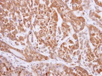Anti-NQO1 antibody used in IHC (Paraffin sections) (IHC-P). GTX113336
