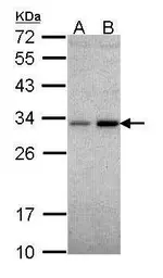 Anti-NQO1 antibody used in Western Blot (WB). GTX113336