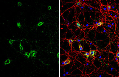 Anti-Grp78 antibody used in Immunocytochemistry/ Immunofluorescence (ICC/IF). GTX113340