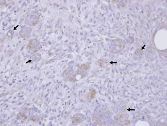 Anti-Stathmin 1 antibody used in IHC (Paraffin sections) (IHC-P). GTX113341
