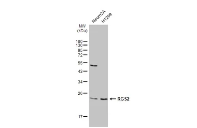 Anti-RGS2 antibody [N1C3-3] used in Western Blot (WB). GTX113349