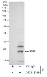 Anti-RGS2 antibody [N1C3-3] used in Immunoprecipitation (IP). GTX113349