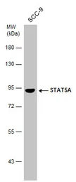 Anti-STAT5A antibody [C2C3], C-term used in Western Blot (WB). GTX113351