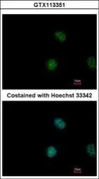 Anti-STAT5A antibody [C2C3], C-term used in Immunocytochemistry/ Immunofluorescence (ICC/IF). GTX113351