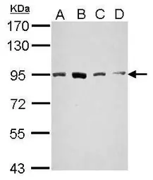 Anti-STAT5A antibody [C2C3], C-term used in Western Blot (WB). GTX113351