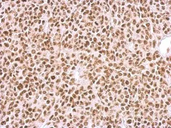 Anti-BCCIP antibody used in IHC (Paraffin sections) (IHC-P). GTX113357