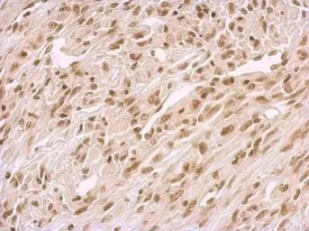 Anti-BCCIP antibody used in IHC (Paraffin sections) (IHC-P). GTX113357