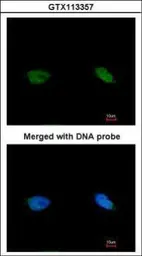 Anti-BCCIP antibody used in Immunocytochemistry/ Immunofluorescence (ICC/IF). GTX113357