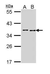 Anti-BCCIP antibody used in Western Blot (WB). GTX113357
