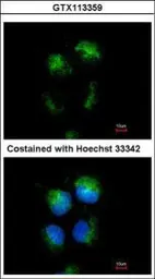 Anti-CD99 antibody used in Immunocytochemistry/ Immunofluorescence (ICC/IF). GTX113359