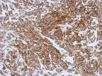 Anti-CD99 antibody used in IHC (Paraffin sections) (IHC-P). GTX113359