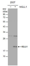 Anti-IGLL1 antibody used in Western Blot (WB). GTX113366