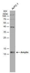 Anti-Amylin antibody [N2C3] used in Western Blot (WB). GTX113367