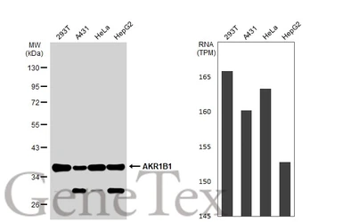 Anti-AKR1B1 antibody [N1C3] used in Western Blot (WB). GTX113381