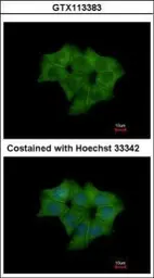 Anti-Annexin IV antibody used in Immunocytochemistry/ Immunofluorescence (ICC/IF). GTX113383