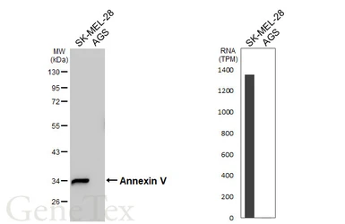 Anti-Annexin V antibody [N2C3] used in Western Blot (WB). GTX113384