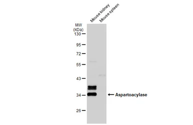 Anti-Aspartoacylase antibody [N1C3-2] used in Western Blot (WB). GTX113389