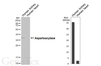 Anti-Aspartoacylase antibody [N1C3-2] used in Western Blot (WB). GTX113389