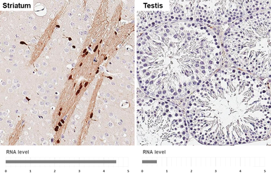 Anti-Aspartoacylase antibody [N1C3-2] used in IHC (Paraffin sections) (IHC-P). GTX113389