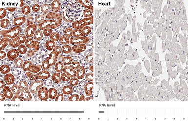 Anti-Aspartoacylase antibody [N1C3-2] used in IHC (Paraffin sections) (IHC-P). GTX113389