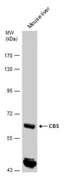 Anti-CBS antibody used in Western Blot (WB). GTX113400