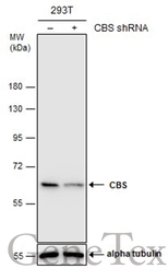 Anti-CBS antibody used in Western Blot (WB). GTX113400