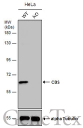 Anti-CBS antibody used in Western Blot (WB). GTX113400