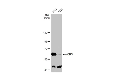 Anti-CBS antibody used in Western Blot (WB). GTX113400
