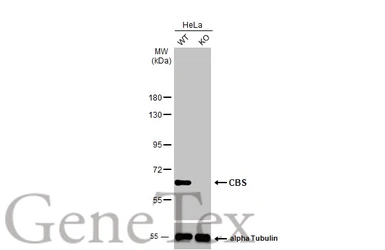 Anti-CBS antibody used in Western Blot (WB). GTX113400