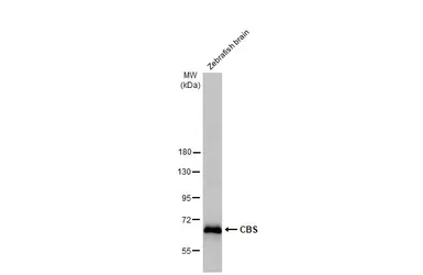 Anti-CBS antibody used in Western Blot (WB). GTX113400