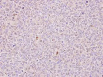 Anti-RCC1 antibody [N1C1] used in IHC (Paraffin sections) (IHC-P). GTX113402